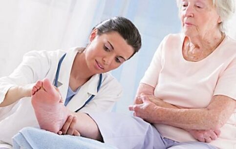 Consultați un medic dacă aveți simptome de varice